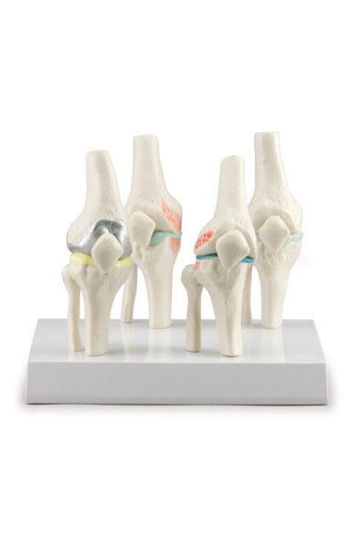 Knee Joints Set