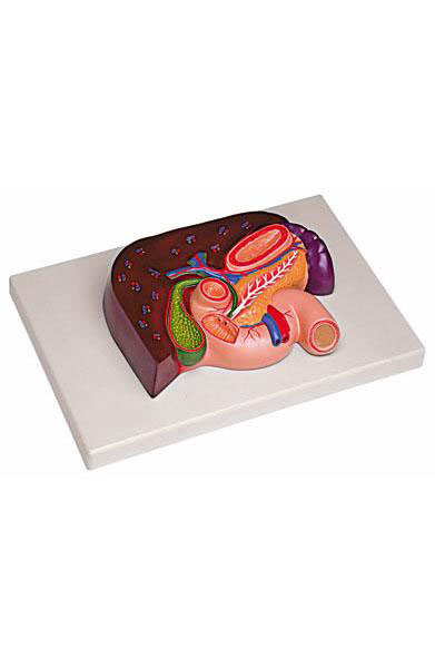 Liver with Gallbladder, Pancreas and Duodenum