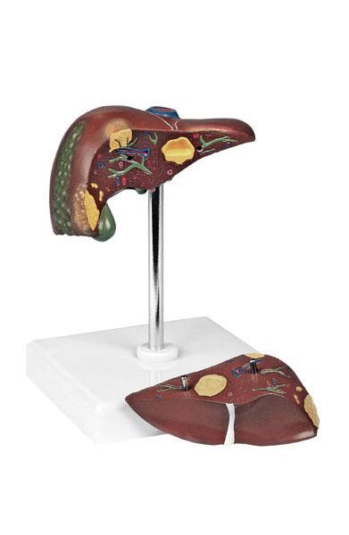 Pathological Model of the Liver