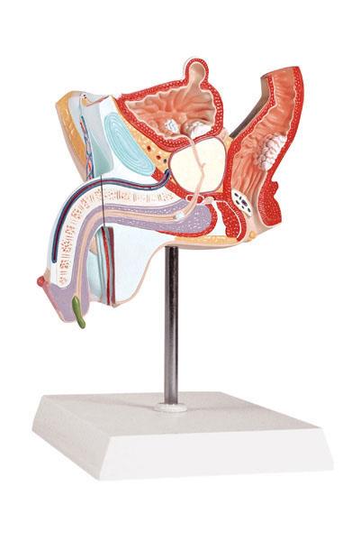 Pathological Model of the Male Urogenital System