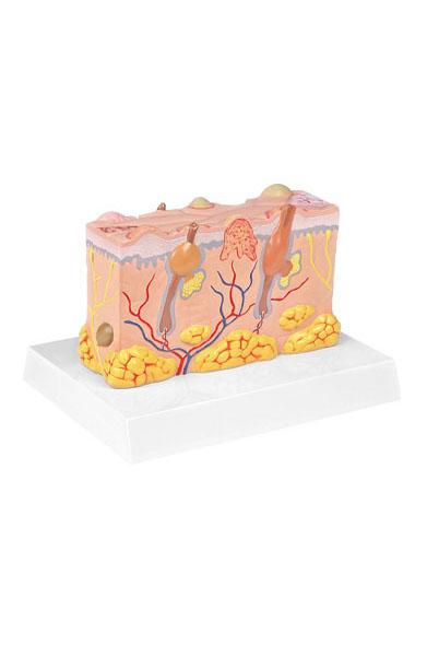 Pathological Model of the Skin